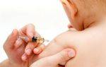 Что такое вакцина бцж (расшифровка) и от чего делают прививку новорожденным детям