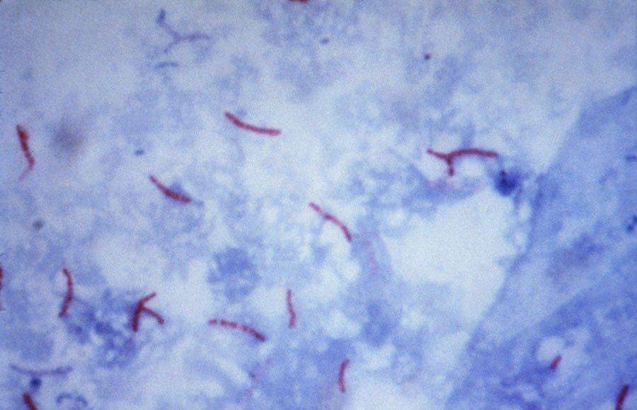 Микобактерии обнаруженные по методу Циля-Нильсена