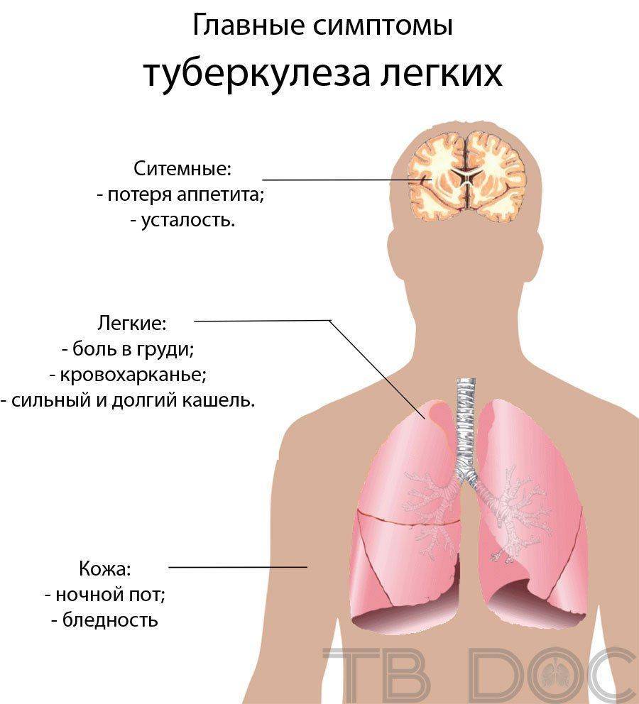 Признаки легочного туберкулеза