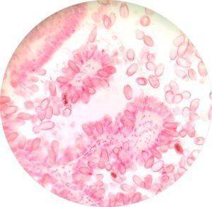 Инфекционное заболевание печени под микроскопом