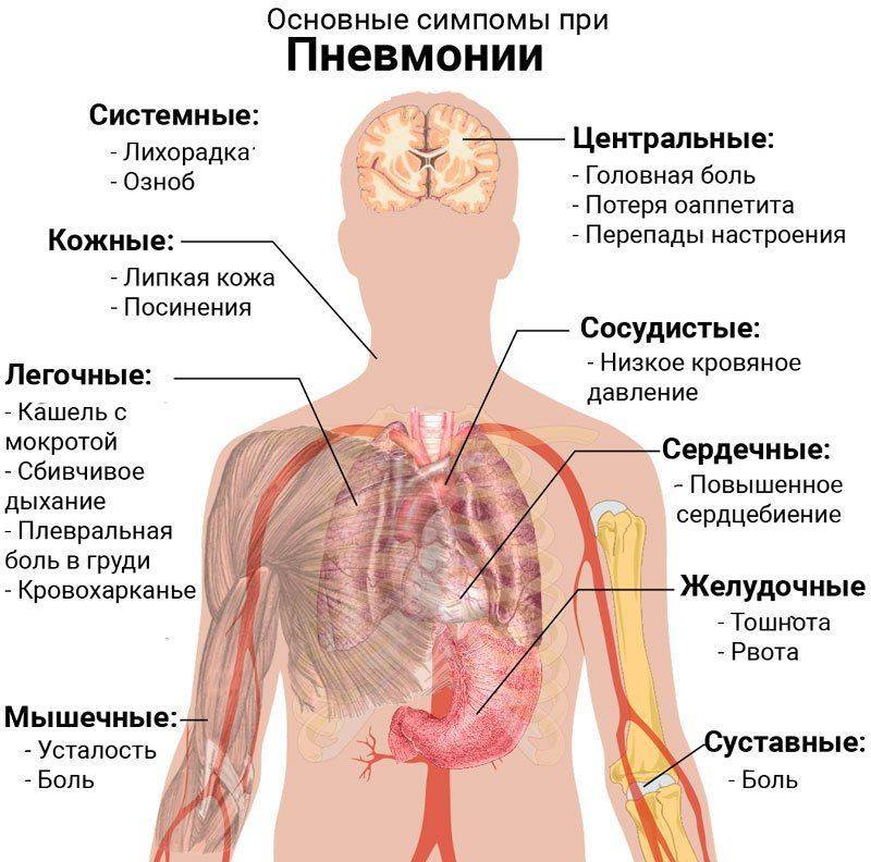 Основные симптомы при пневмонии
