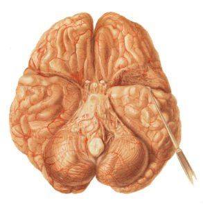 Мозг больного туберкулезом