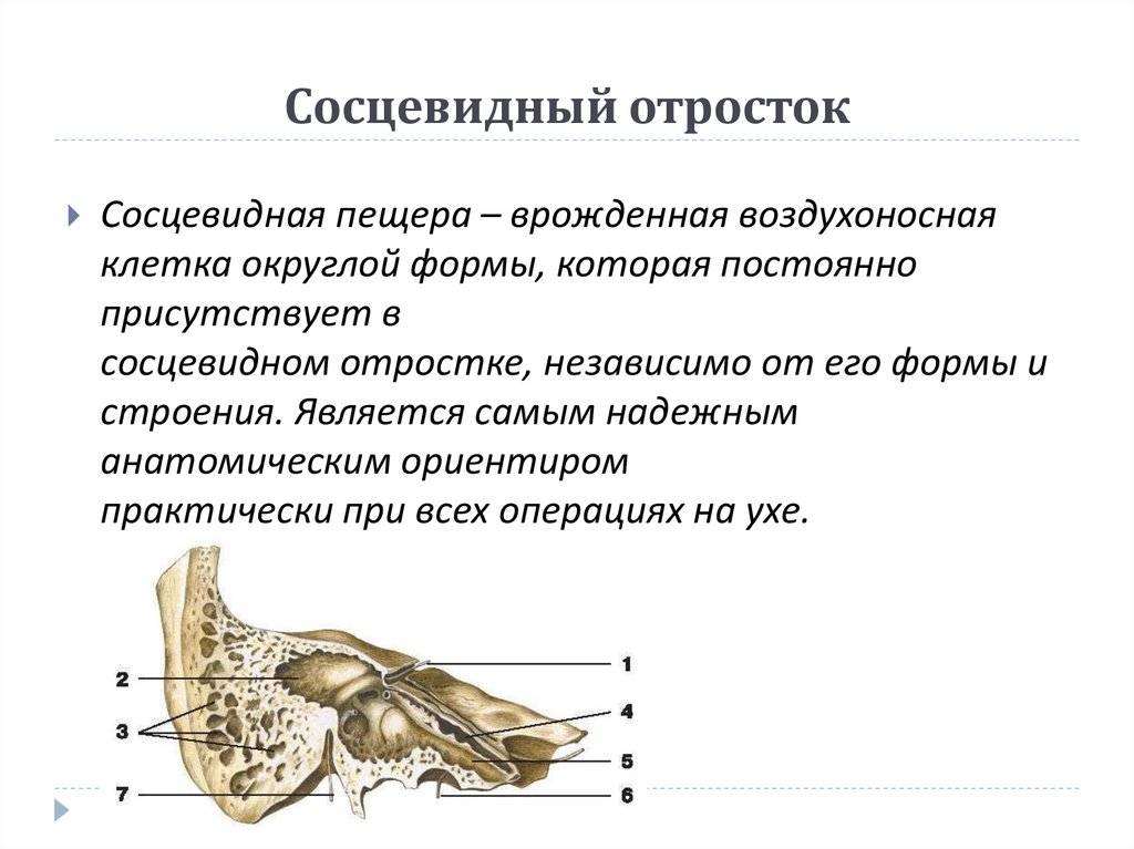 Височная кость анатомия на русском. левосторонний мастоидит характеристика симптомы лечение прогноз - человек и здоровье