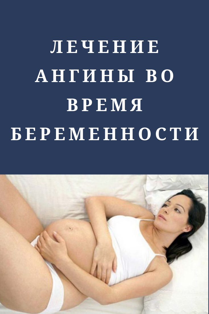 Тонзиллит при беременности (хронический, острый) – причины возникновения, симптомы (пробки), последствия для ребенка