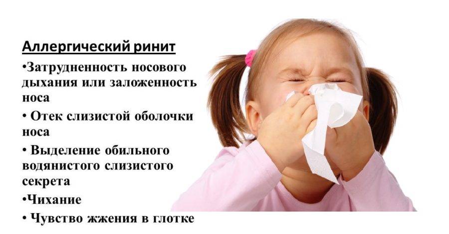 Конъюнктивит и кашель у ребёнка: проверенные способы лечения и профилактики