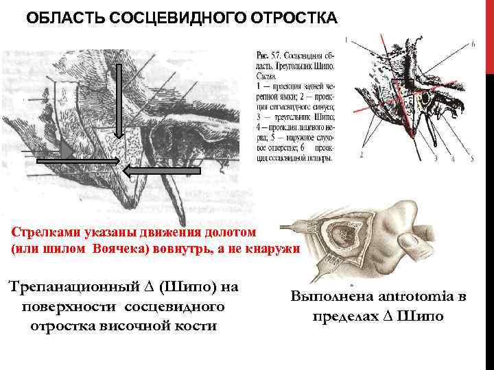 Височная кость анатомия на русском. левосторонний мастоидит характеристика симптомы лечение прогноз