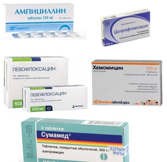 Препараты, таблетки и антибиотики для быстрого лечения ларингита у взрослых и детей