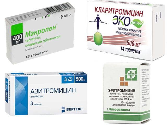 Антибиотики в таблетках при гайморите у взрослых: какие выбрать