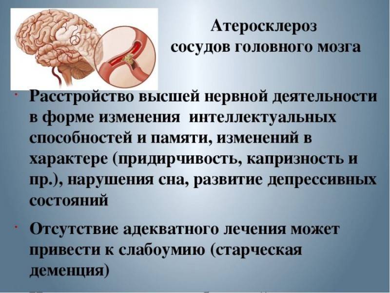 Диета При Атеросклерозе Головного Мозга