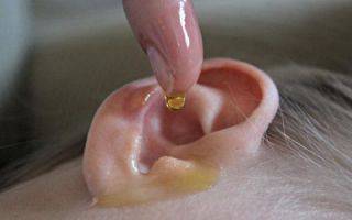 Как вылечить отит уха в домашних условиях: основные подходы к лечению