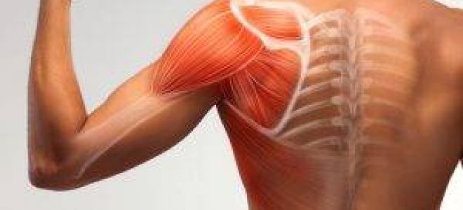 Мышечная боль (миалгия)