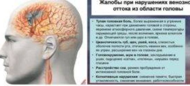 Затруднение венозного оттока головного мозга