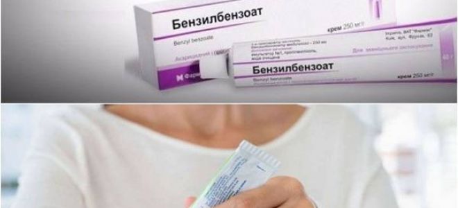 Самые эффективные народные средства от чесотки: как быстро избавиться в домашних условиях