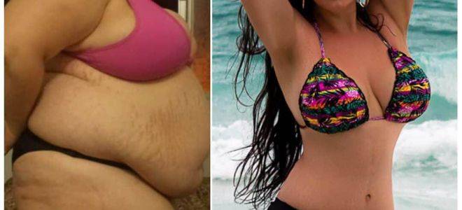 Язва желудка: диета, питание при обострении, меню на неделю с рецептами, разрешенные и запрещенные продукты