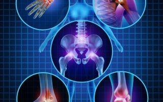 Ревматоидный артрит: диагностика по критериям