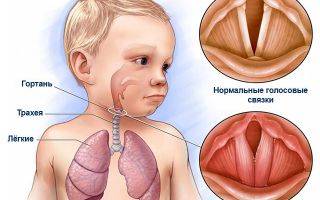 Доктор комаровский о том, чем лечить красное горло у ребенка