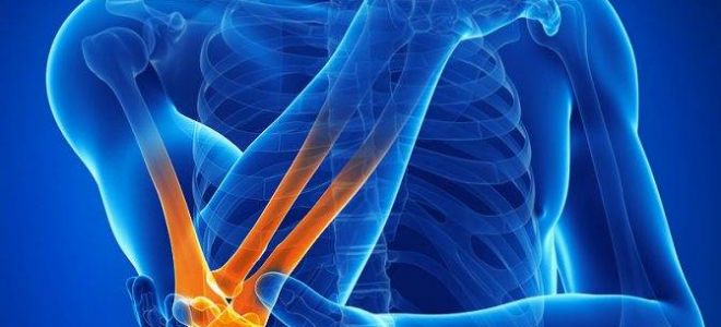 Основные виды и способы лечения тендинита