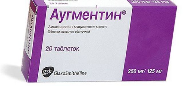 Тонзиллит у детей: причины и методы лечения