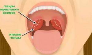 Что может помочь если щекочет в горле и вызывает кашель