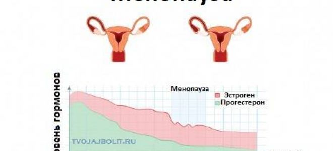 Ранний климакс и его лечение