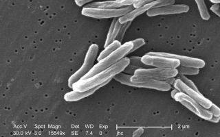 Патогенез и этиология туберкулеза