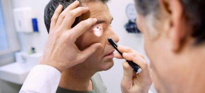 Лечение дакриоцистита народными средствами