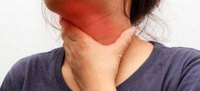 Шифр мкб 10 фолликулярная ангина