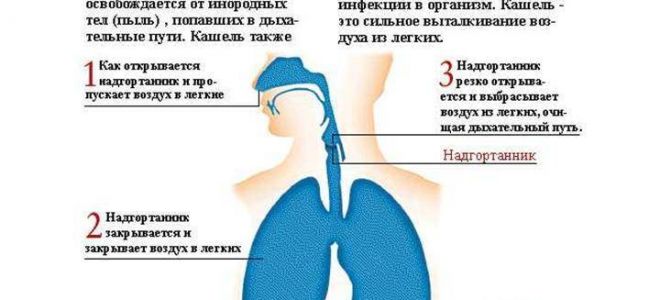 Почему возникает лающий внезапный кашель у ребенка и как помочь малышу