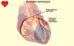 Как можно победить ишемическую болезнь сердца?