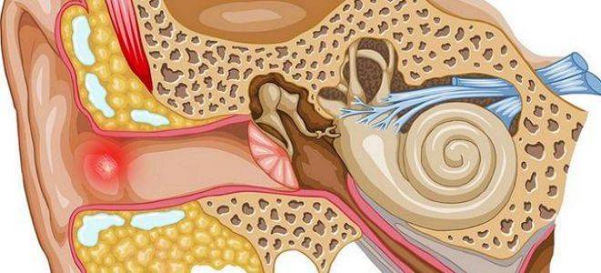 Заложено ухо, но не болит — что делать, причины и способы лечения