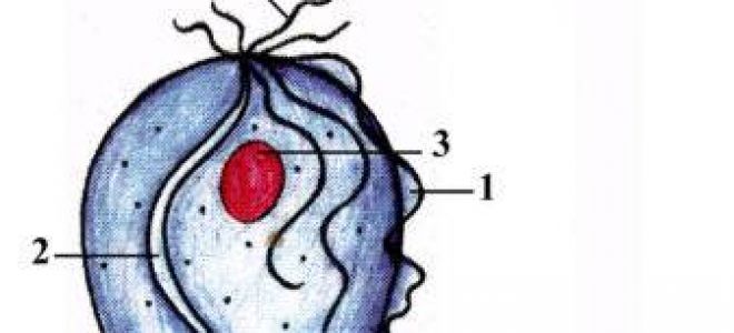 Трихомониаз: схемы лечения патологии у женщин