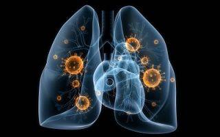 Инфекционная пневмония: симптомы, лечение, пути передачи