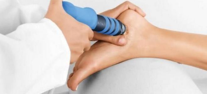 Пяточная шпора: лечение народными средствами с помощью йода