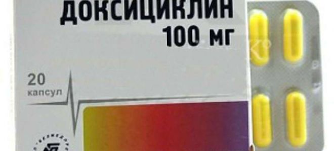 Лечение одонтогенного гайморита: эффективные способы и рецепты народной медицины