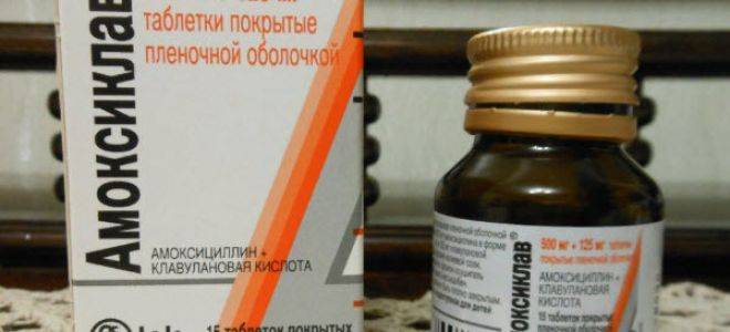 Амоксициллин при ангине
