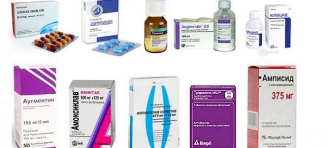 Причины обструктивного бронхита у ребёнка