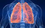 Можно ли излечить туберкулез полностью?