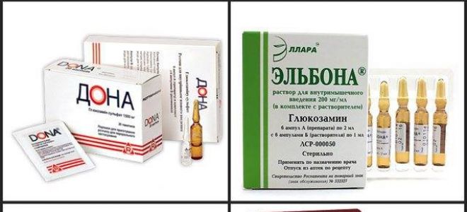 Что собой представляет синовит плечевого сустава