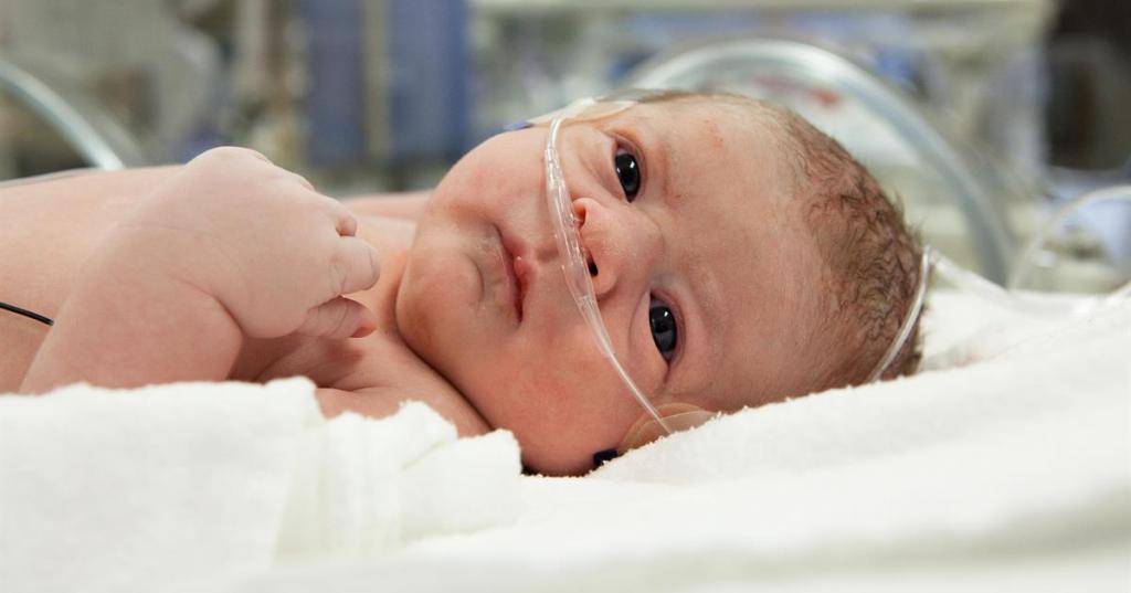 Развитие пневмонии у новорожденного после кесарево сечения – причины, симптомы, лечение и последствия
