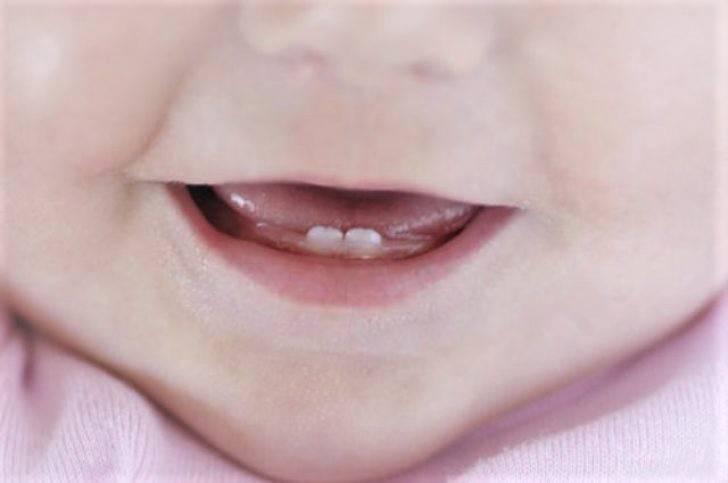 Сопли при прорезывании зубов (может ли быть насморк на зубы у детей, мнение комаровского)