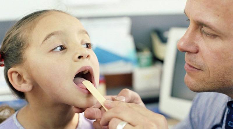 Герпес в горле у ребенка – как распознать и лечить герпесную ангину у детей?