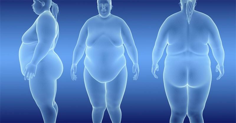 Морбидное ожирение: 5 видов лечения, которые помогут победить болезнь и её последствия