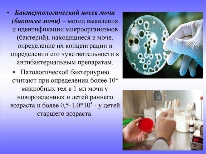 Клебсиелла пневмония при беременности: в мазке и в моче проявление болезни, а также симптоматика и особенности развития, и необходимое лечение | fok-zdorovie.ru