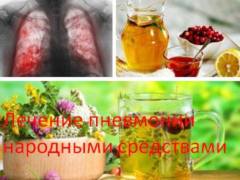Лечение народными средствами воспаления лёгких (пневмонии)