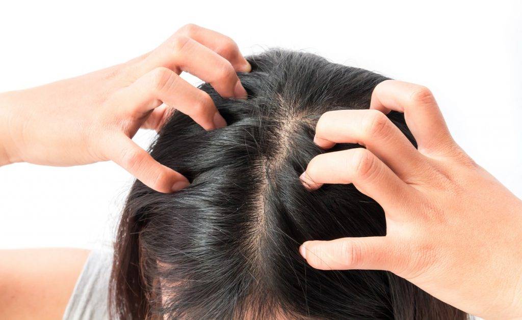 Шампунь от перхоти и выпадения волос: правила выбора и обзор 5 хороших средств