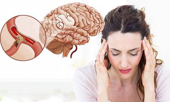 Сильная головная боль спазмами: причины, лечение, эффективные препараты