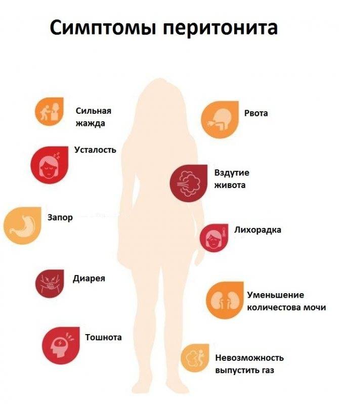 Признаки перитонита: основные симптомы при остром и хроническом воспалении