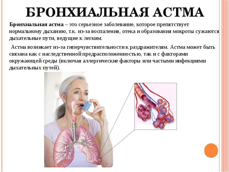 Характерные признаки и симптомы, лечение кашлевой формы бронхиальной астмы у детей и взрослых