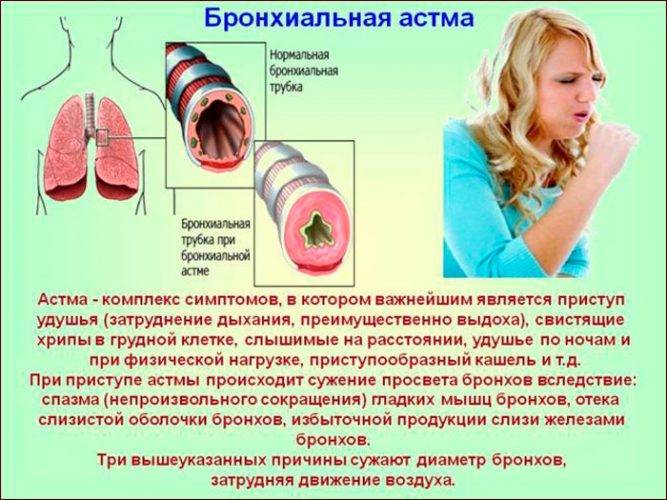 Трахеит. описание, симптомы, причины и лечение трахеита