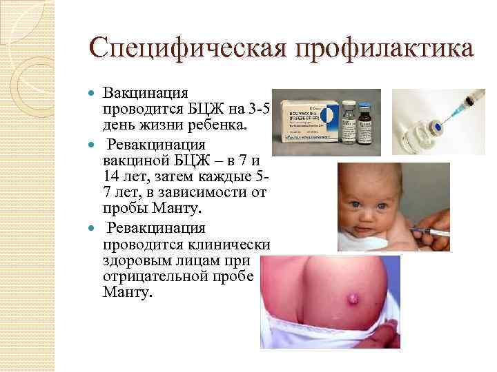 Прививки бцж детям: когда делают, как переносятся и стоит ли ставить уколы